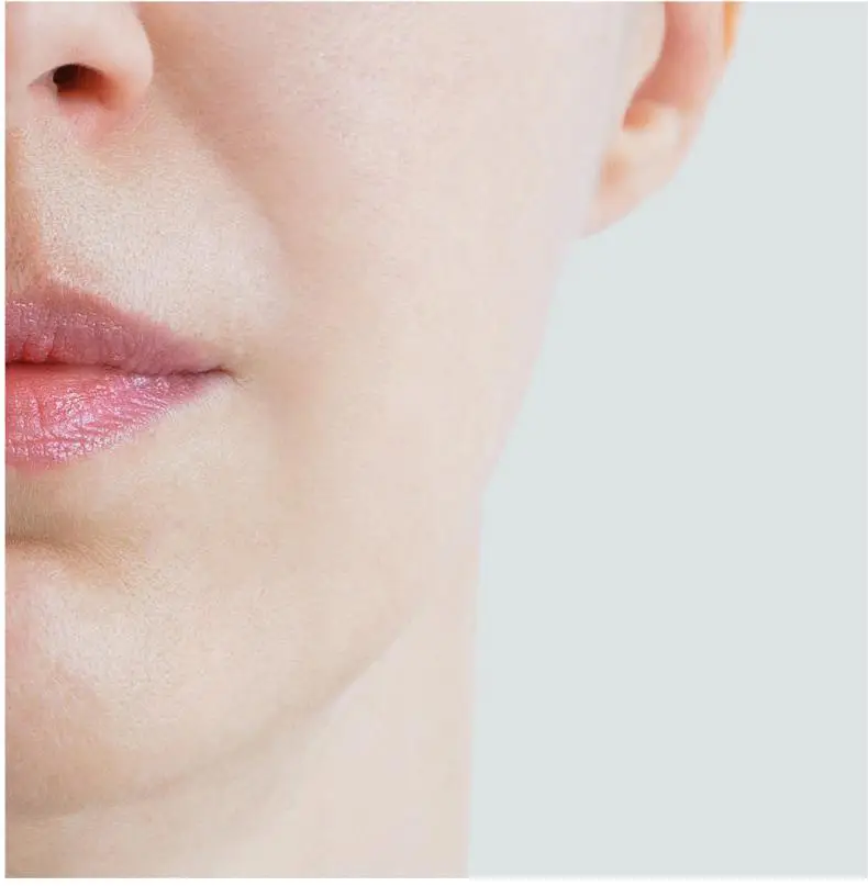 dermal filler wholesale