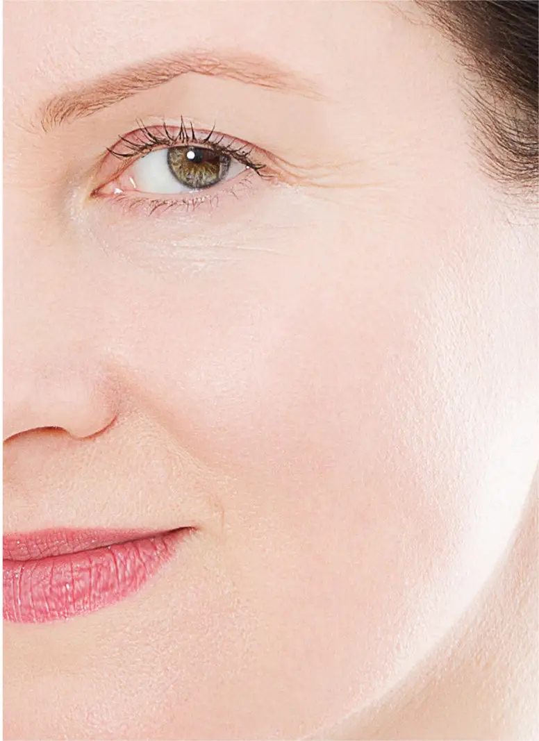 dermal filler wholesale