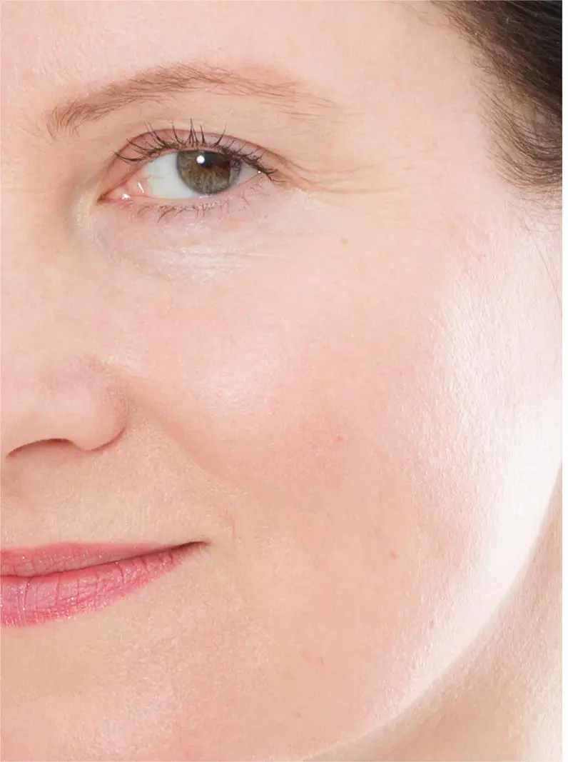 dermal filler wholesale